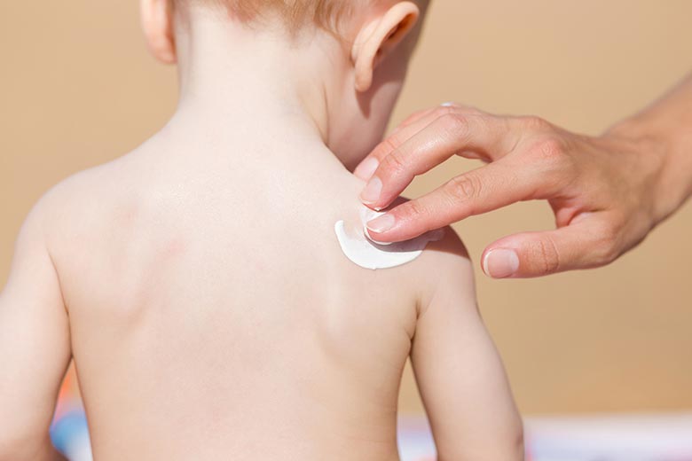 Comment traiter les cicatrices de bébé ?