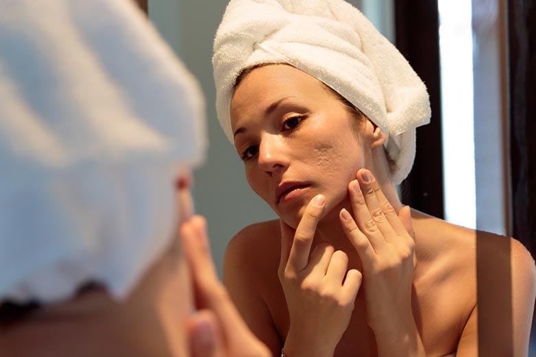Cicatrices sur le visage : quelles sont les solutions pour les atténuer ?