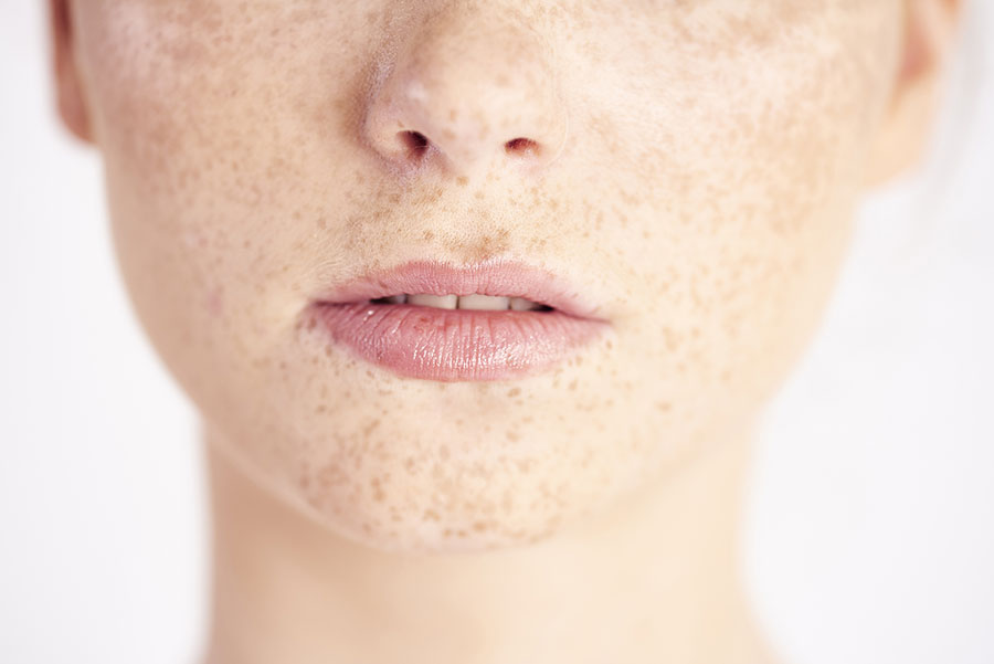 Pourquoi et comment bien hydrater ses lèvres ?