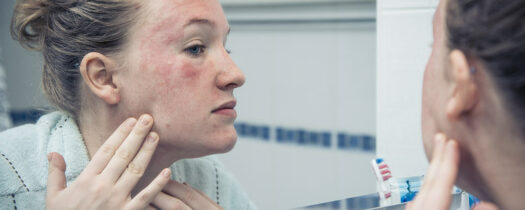 Plaques rouges sur le corps, que faire ?